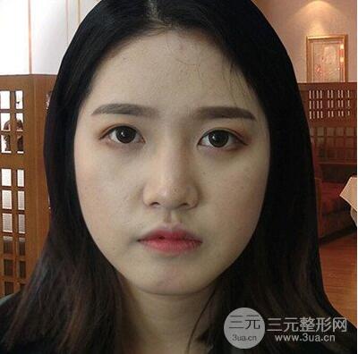 张建龙做鼻部整形技术如何?拥有好看鼻子就这么简单!