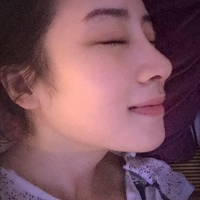 俞良钢颧骨内推案例分享，俞良钢的技术就是这么6~~~