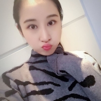 俞良钢颧骨内推案例分享，俞良钢的技术就是这么6~~~