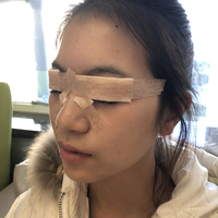 重庆当代整形做双眼皮好不好?能值得信赖吗?