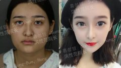 心有不平，我做这些过分吗？——上海首尔丽格 width=