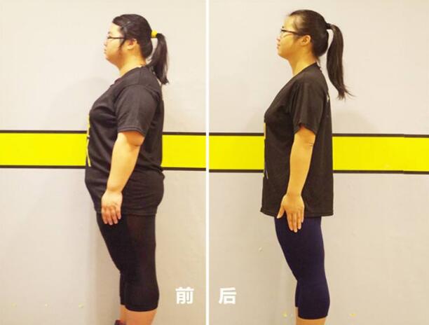 重庆镭射溶脂价格大概是多少?俺想知道!
