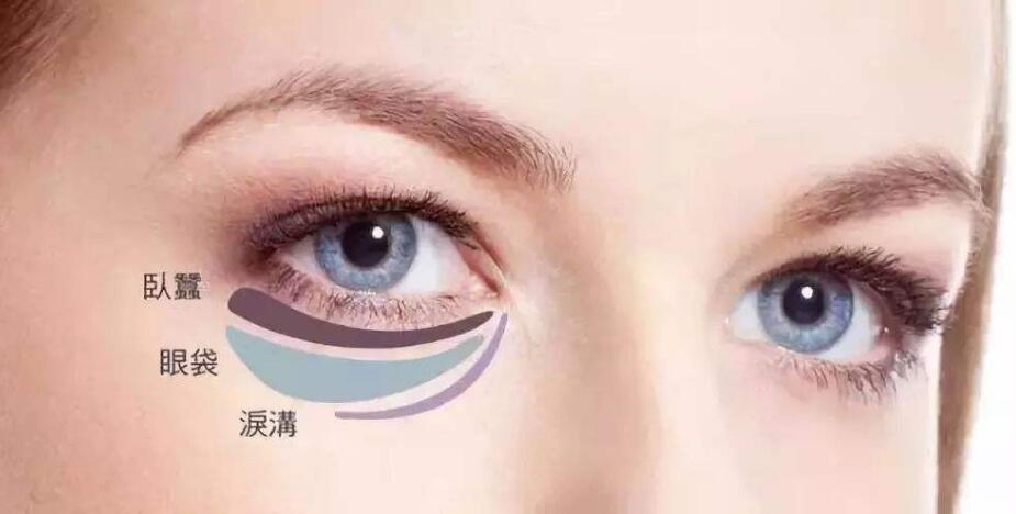 光乳化去眼袋多少钱呢?我心里没啥数啊!