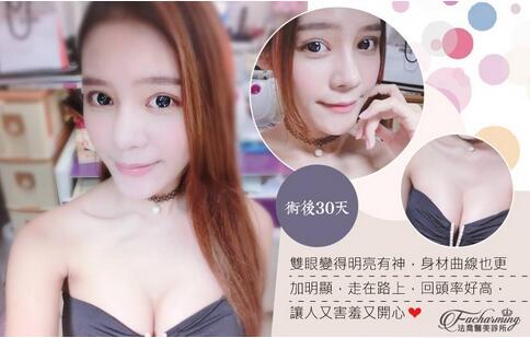 盛宗顺医生做双眼皮怎么样？一起来看看这篇案例吧！