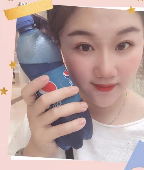北京西美医院靠谱吗？来看看刘野院长做的双眼皮案例哇！