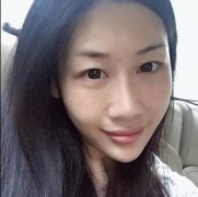 王世勇双眼皮修复案例分享：谈谈双眼皮失败后的经历 width=