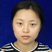 中山三院整形科【价目表】分享：全切双眼皮真实对比图恢复经历 width=