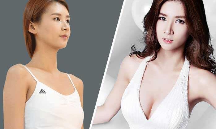 蜜桃假体隆胸的危害有哪些?优点又有那些呢?