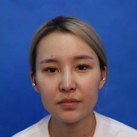 北京史三八医疗美容医院怎么样?皮肤美容案例分享~