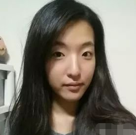 上海宏康整形医院正规吗?附面部填充案例及果图~