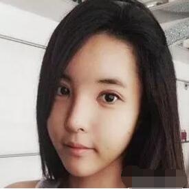 上海宏康整形医院正规吗?附面部填充案例及果图~