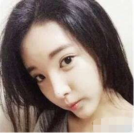 上海宏康整形医院正规吗?附面部填充案例及果图~