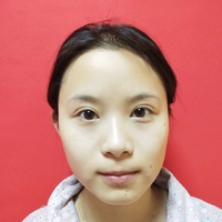 肖蓉医生技术如何?隆鼻案例分享~