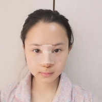 肖蓉医生技术如何?隆鼻案例分享~
