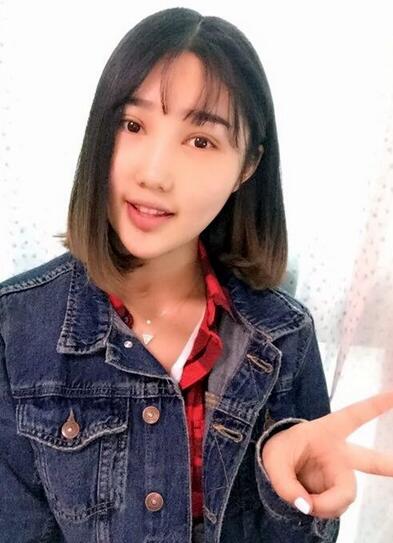 韩式微创双眼皮案例分享，还有恢复期图片哟~