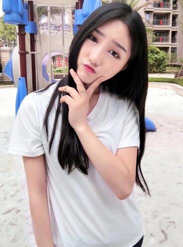韩式微创双眼皮案例分享，还有恢复期图片哟~