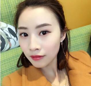 周钧医生技术如何?眼部案例及果图分享~