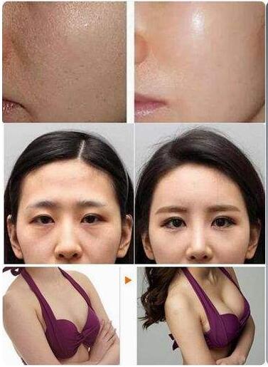 无锡瑞丽整形医院怎么样?陈光平医生技术如何?