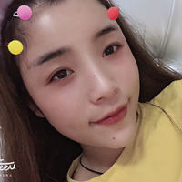 上海沪西整形医院怎么样?附脂肪填充案例及果图~