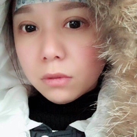 芜湖朱唯力双眼皮案例及果图分享，惊掉了我的下巴!