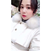 芜湖朱唯力双眼皮案例及果图分享，惊掉了我的下巴!