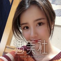 王英俊医生技术如何?自体活细胞脂肪填充案例分享~