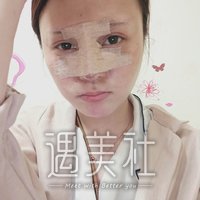 周珃医生技术如何?小翘鼻案例及果图分享~