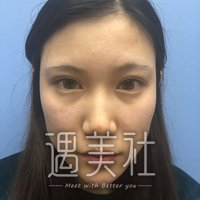 广州ot整形医院技术怎么样?网红脸整形案例分享~