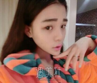 李耐阅整容前后对比图曝光，这还是同一个人吗?