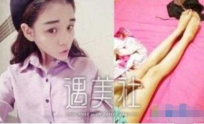 李耐阅整容前后对比图曝光，这还是同一个人吗?