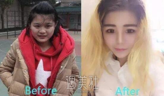 李耐阅整容前后对比图曝光，这还是同一个人吗?