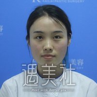 广州ot整形谭文立医生技术如何?做鼻子的果能够得到吗?
