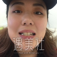 维乐口腔怎么样?我这大黄牙能够得到改变吗?