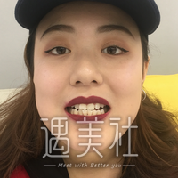 维乐口腔怎么样?我这大黄牙能够得到改变吗?