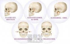 磨腮削骨恢复期到底有多长?怎样才能想要的果? width=