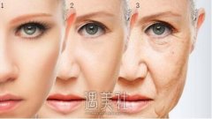 成都点阵激光一次有果吗?还能重返十八岁吗? width=