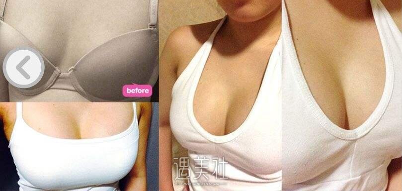 听说妙桃琴面丰胸果好，具体好在哪里呢?