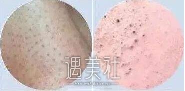 黑脸娃娃去黑头价格是不是很便宜?【黑脸娃娃价格表展示】