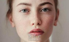 长沙做oe光子嫩肤的价格一般好多?俺想了解下! width=