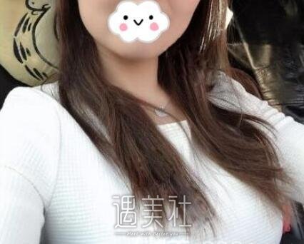 艾米丽成都潘红伟案例展示，从A变C不是梦!