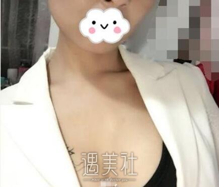 艾米丽成都潘红伟案例展示，从A变C不是梦!