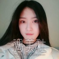 芜湖朱唯力双眼皮案例分享，一双眼就此改变一个人!