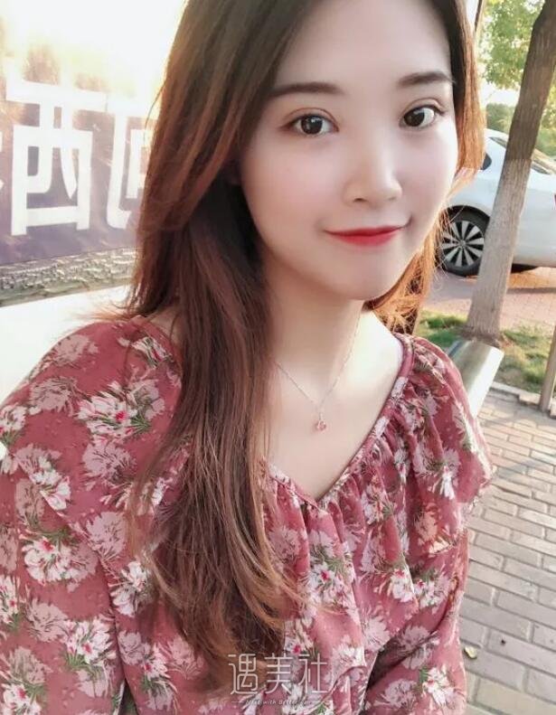 樊辉华双眼皮案例分享，亲身讲述手术及恢复全过程!