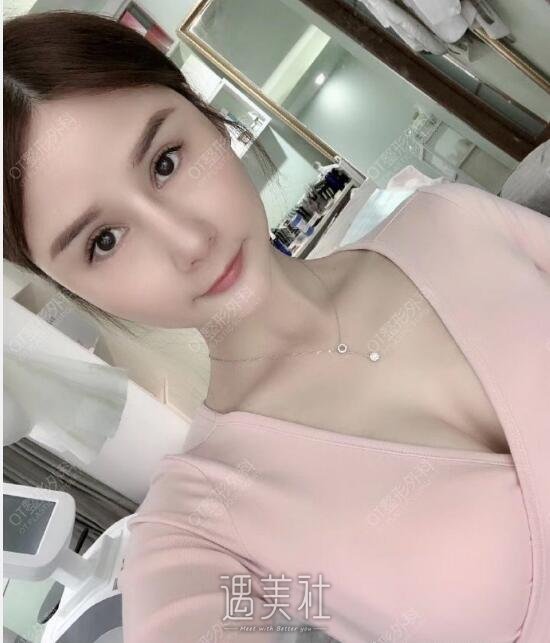 谭文立医生技术好吗?脂肪填充真实案例分享一波~