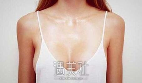 傲诺拉有什么好的，具体好在哪里?