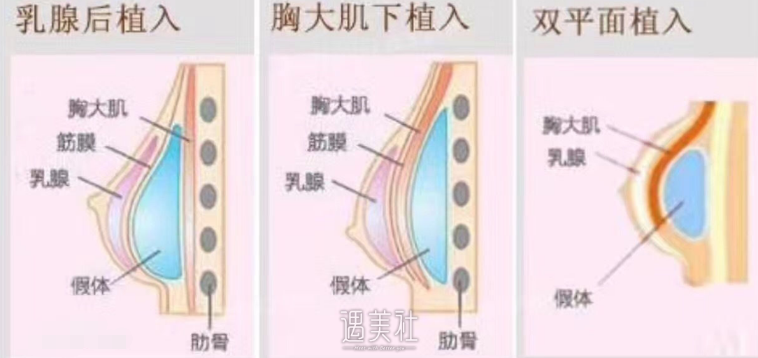 傲诺拉有什么好的，具体好在哪里?
