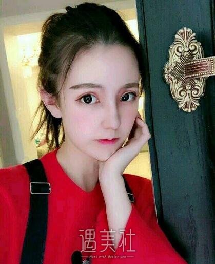 常德凯尔美斯冯涛做双眼皮隆鼻如何，案例告诉你！