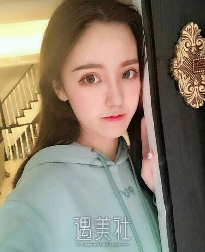 常德凯尔美斯冯涛做双眼皮隆鼻如何，案例告诉你！