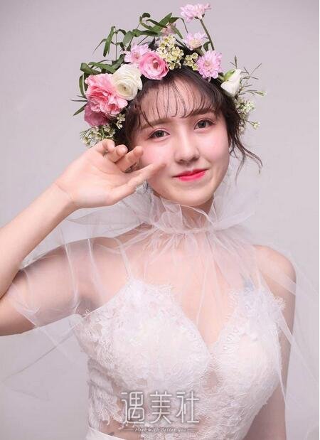 常德凯尔美斯冯涛做双眼皮隆鼻如何，案例告诉你！