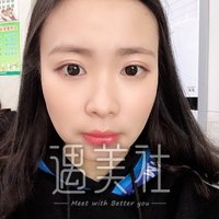 磨腮削骨恢复期到底有多长?亲身案例为你展示~